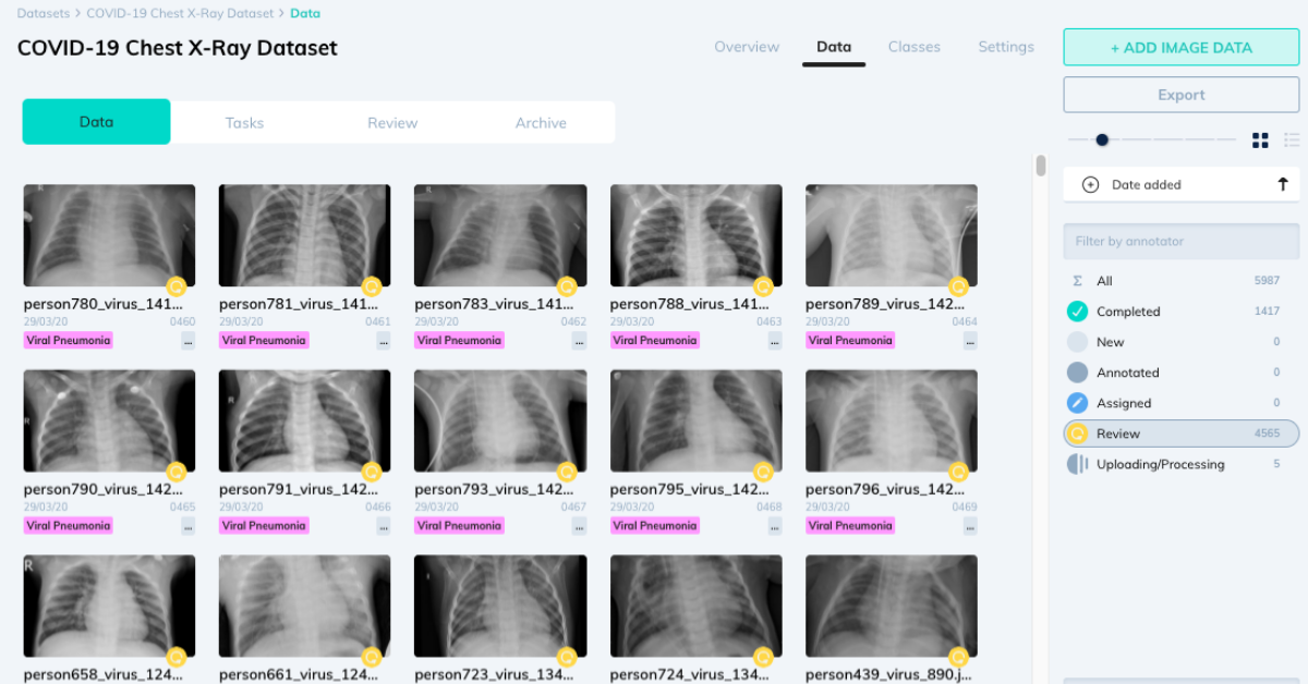 V7 Labs & CloudFactory Release Annotated X-Ray Dataset to Aid in COVID-19 Research